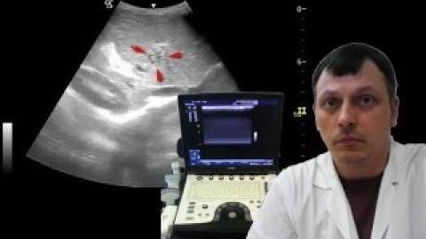 Детское УЗИ брюшной полости - Кавернозная трансформация воротной вены смотреть онлайн