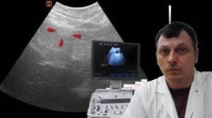 Детское УЗИ брюшной полости -  Псевдоопухоль печени