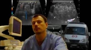 Детское УЗИ кишечника - Кишечная инвагинация, кишечная непроходимость, асцит