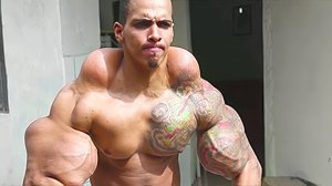 5 НЕУДАЧНЫХ ПЛАСТИЧЕСКИХ СЛУЧАЕВ