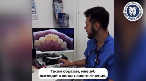 Лечение кариеса в зоне улыбки. Костомаров Иван Александрович стоматолог-терапевт