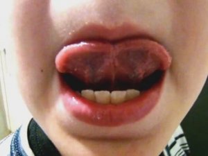 Артикуляционное упражнение "Вкусное варенье"