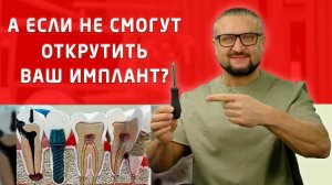 ИМПЛАНТЫ, поставленные 10 лет назад, могут серьезно озадачить любого стоматолога!