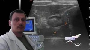 Детское УЗИ желудка - Пилороспазм