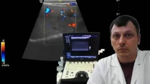 Детское УЗИ брюшной полости - Многоочаговое поражение печени смотреть онлайн