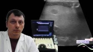 Детское УЗИ брюшной полости - Диффузно-очаговые изменения печени, толстая левая почка