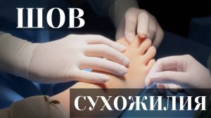 Шов застарелого травматического разрыва сухожилия разгибателя 1 пальца стопы