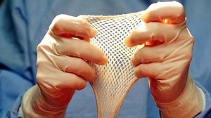 Расщепленный, свободный лоскут. Перфорировать или нет?