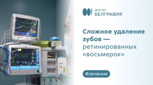 Сложное удаление зубов - ретинированных «восьмерок»