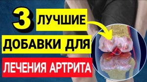 ТОП-3 ПОЛЕЗНЫХ ДОБАВОК ПРИ АРТРИТЕ, КОТОРЫЕ РЕАЛЬНО ПОМОГАЮТ.