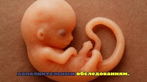 Тема запрета абортов вызвала много за и против в Приморье