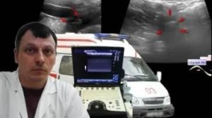 Детское УЗИ брюшной полости - Острый аппендицит