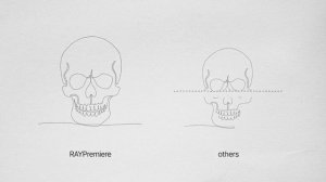 Introducing RAY PreMiere, 18x16 CBCT