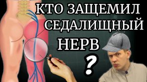 Разблокировка защемлённого седалищного нерва при острой боли / в 90 % случаев виновата ...