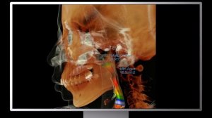 RAY PreMiere — True Size FOV