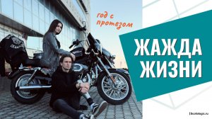 Год на протезе ноги после ДТП