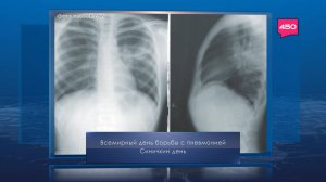 Всемирный день борьбы с пневмонией. Календарь Губернии от 12 ноября