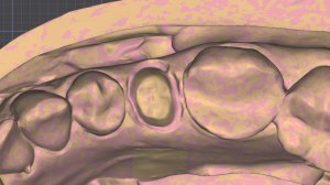 Как отсканировать Десневую маску при ее отсутствии.