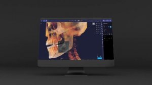 Ray Vision SW — Slice Explorer
