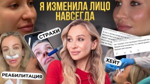 РИНОПЛАСТИКА: МОЙ ПУТЬ К НОВОЙ ВНЕШНОСТИ | ДНЕВНИК РЕАБИЛИТАЦИИ