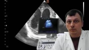 Детское УЗИ головного мозга (нейросонография) и брюшной полости - Двойня - ВЖК