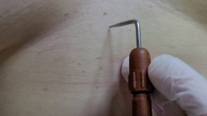 Удаление мелких папиллом на коже тела