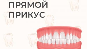 Прямой прикус