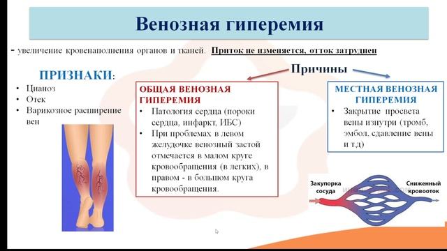 Видео-лекция №25.1. Местные расстройства кровообращения. Гиперемия, инфаркт и ишемия смотреть онлайн
