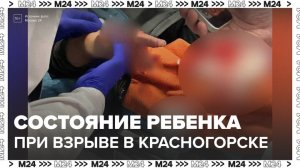 В Минздраве рассказали о стоянии пострадавшего при взрыве ребенка в Красногорске - Москва 24