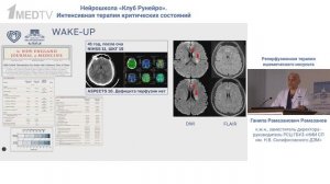 Реперфузионная терапия ишемического инсульта Рамазанов Г.Р. 2025