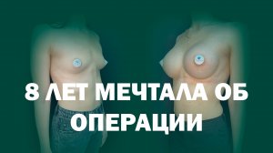 Увеличение груди анатомическими имплантами Mentor 420 мл у доктора Волкова