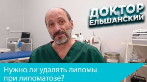 Нужно ли удалять липомы при липоматозе?