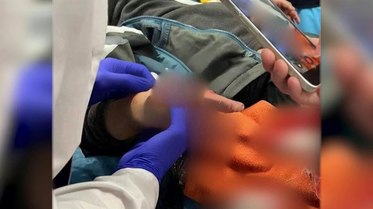 В Красногорске ребенок пострадал от взрыва, подняв деньги с земли