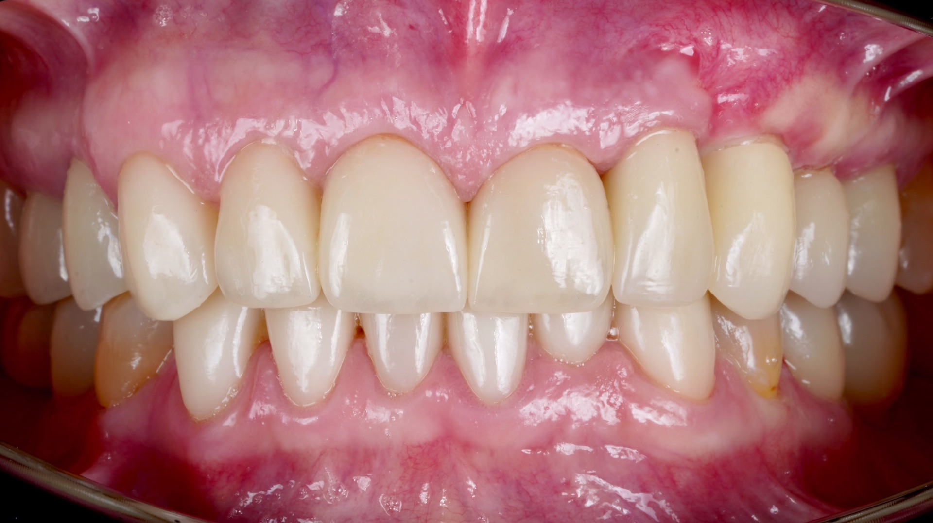 Не каждому по плечу тотальная работа за короткий промежуток времени.