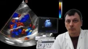 Детское УЗИ сердца (эхокардиография) - Двухструйная регургитация на митральном клапане