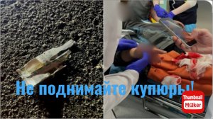 10 летний мальчик поднял купюру и ему оторвало пальцы