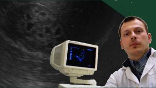 Детское УЗИ почек - Симптом перимедуллярного кольца / медуллярный нефрокальциноз смотреть онлайн