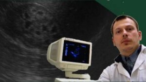 Детское УЗИ почек - Симптом перимедуллярного кольца / медуллярный нефрокальциноз