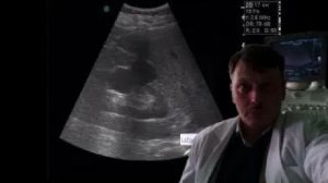 УЗИ почек - Кисты почки