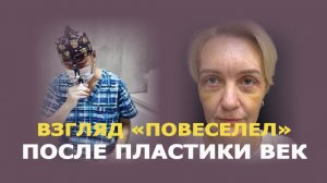 Как проходит блефаропластика у женщин: до и 2 недели после