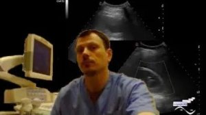 Детское УЗИ почек - Состояние после лечения кисты почки