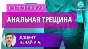 Профессор Нечай И.А.: Анальная трещина