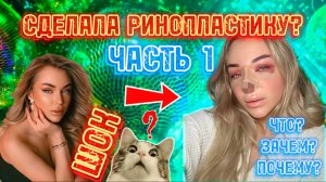 СДЕЛАЛА РИНОПЛАСТИКУ?🫣