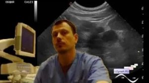 Детское УЗИ почек - Кистозная дисплазия, нефропатия, гематурия