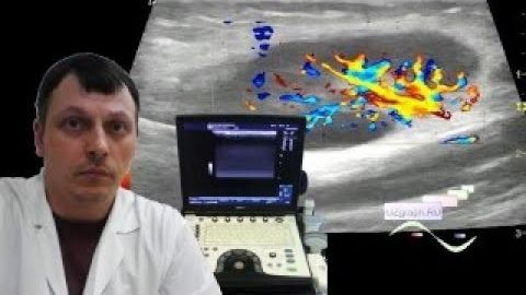 Детское УЗИ мягких тканей - Отек и боль в проксимальной трети бедра смотреть онлайн