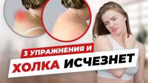 Вы будете в шоке! Вот почему появляется холка и КАК УБРАТЬ вдовий горбик навсегда!