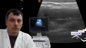 Детское УЗИ почек - "Песок" в почках