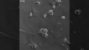 Инфантильная гемангиома возникает из нарушенной регуляции, но не полностью трансформированной