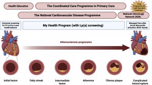 Польша - лидер по внедрению эффективных программ для лечения нарушений липидного обмена