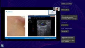 Ультразвуковая визуализация в косметологии